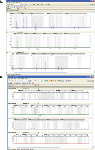 Results of STR amplifications of DNA isolated from long bones.